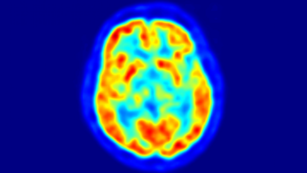 Neuroimaging Image